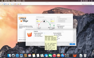 SPINA Thyr on Mac OS X 10.5
                                      (Leopard)